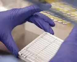 آزمون ویروسی در گربه(ویروس لوسمی گربه (FeLV) به روش PCR)