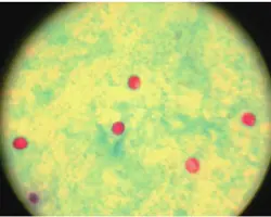 آزمون بیماری اسهال در سگ وگربه(انگل‌‌‌‌‌های گوارشی به روش  شناورسازی کریپتوسپوریدیوم  به روش بررسی میکروسکوپی)
