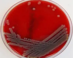 آزمون  بیماری‌‌‌‌‌های باکتریایی در قزل آلا و ماهی خاویاری(ردیابی باکتری Aeromonas salmonicida به روش PCR)
