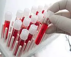 آزمایش  اندازه گیری فاکتور های بیوشیمیایی کامل خون( CBT)