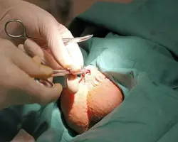 جراحی عقیم سازی سگ نر زیر ده کیلو