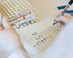 آزمون انگل خونی در گربه(سیتوکسزون فلیس به روش PCR)