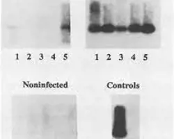 آزمون تب با منشأ ناشناخته در گربه(ویروس نقص ایمنی گربه (FIV) به روش PCR)