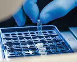 آزمون  انگل‌‌‌‌‌های خونی(تیلریا به روش PCR)